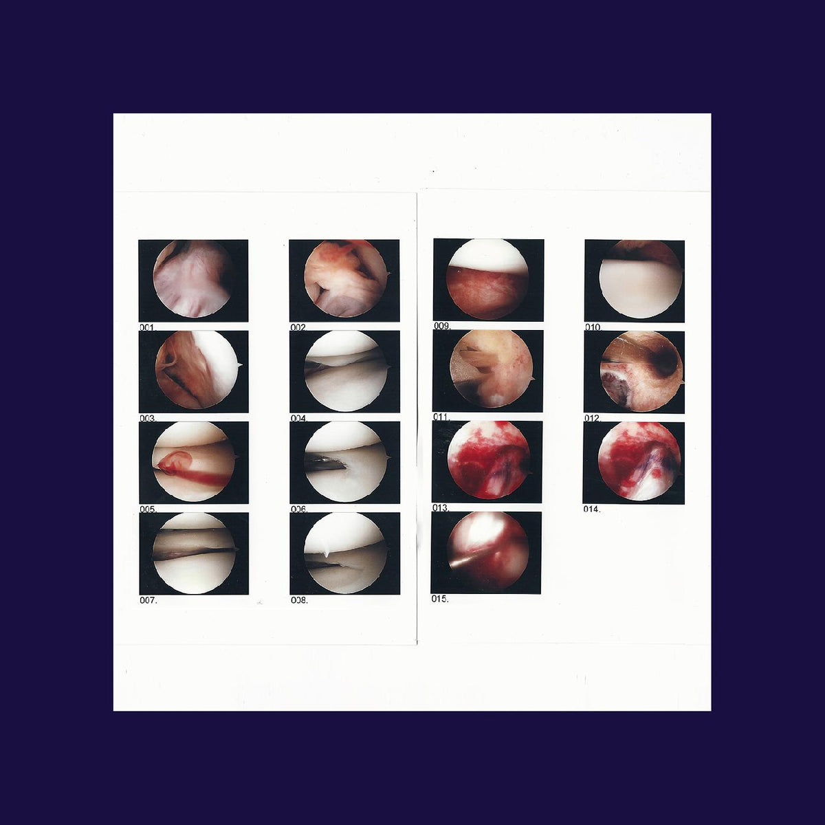The Cradle | Laughing In My Sleep - CD